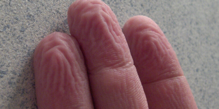 Ha vizesek lesznek az ujjaid, mindig ugyanúgy ráncosodnak