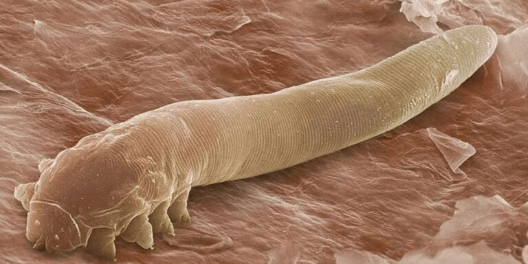 Tudtad, hogy az arcodon cuki kis atkák legelésznek?